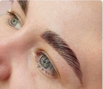 (115) Brow-lifting / Browlift