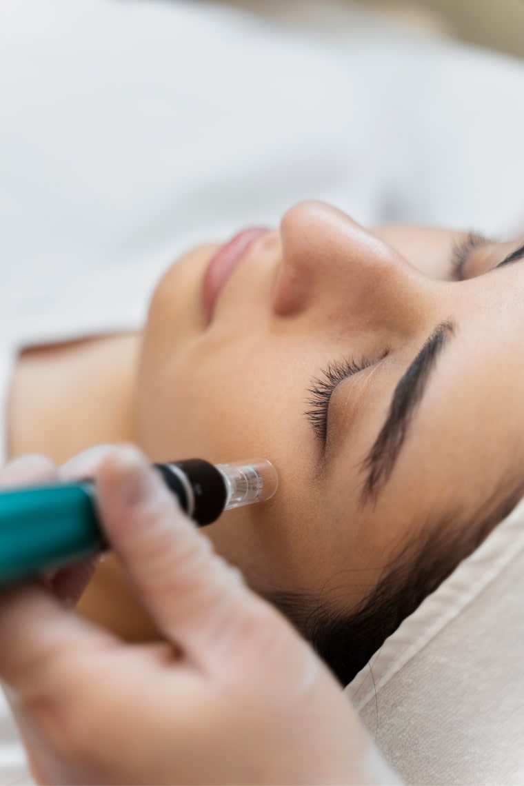 Microneedeling / Microdermabrasion